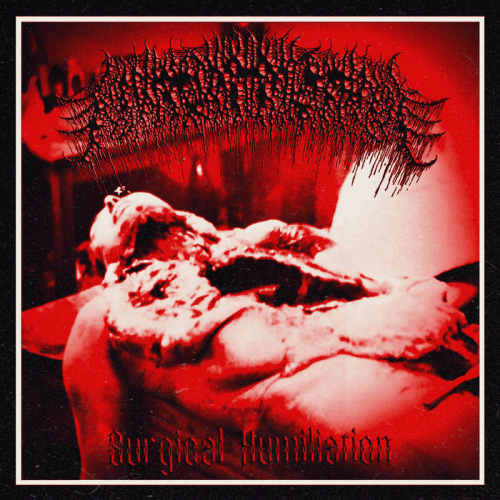 Floccinaucinihilipilification (USA) : Surgical Humiliation